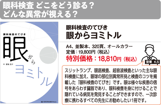 眼科検査どこをどう診る？どんな異常が視える？