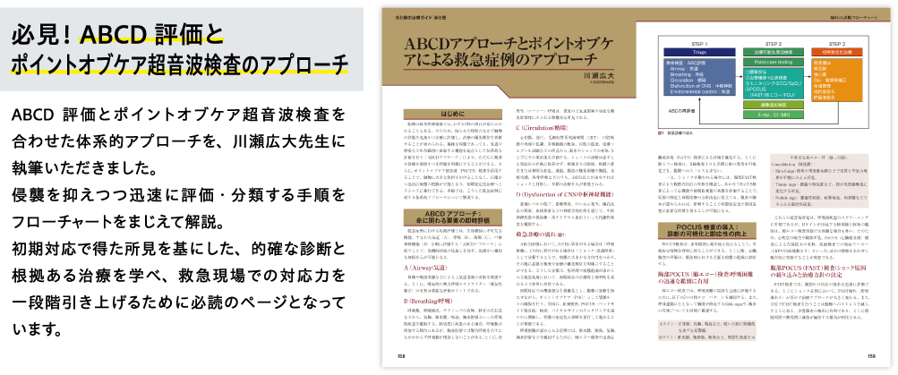 必見！ABCD評価とポイントオブケア超音波検査のアプローチ