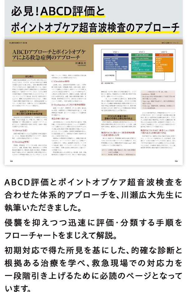 必見！ABCD評価とポイントオブケア超音波検査のアプローチ